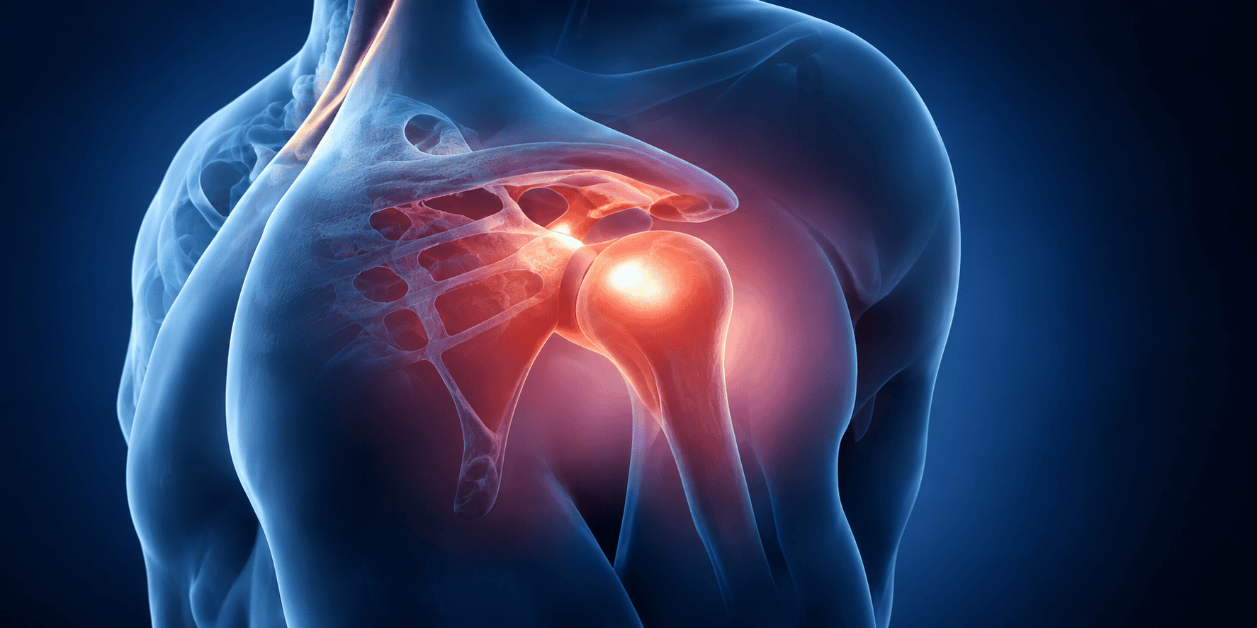 Medical illustration of a shoulder joint highlighting the shoulder and upper arm bones
