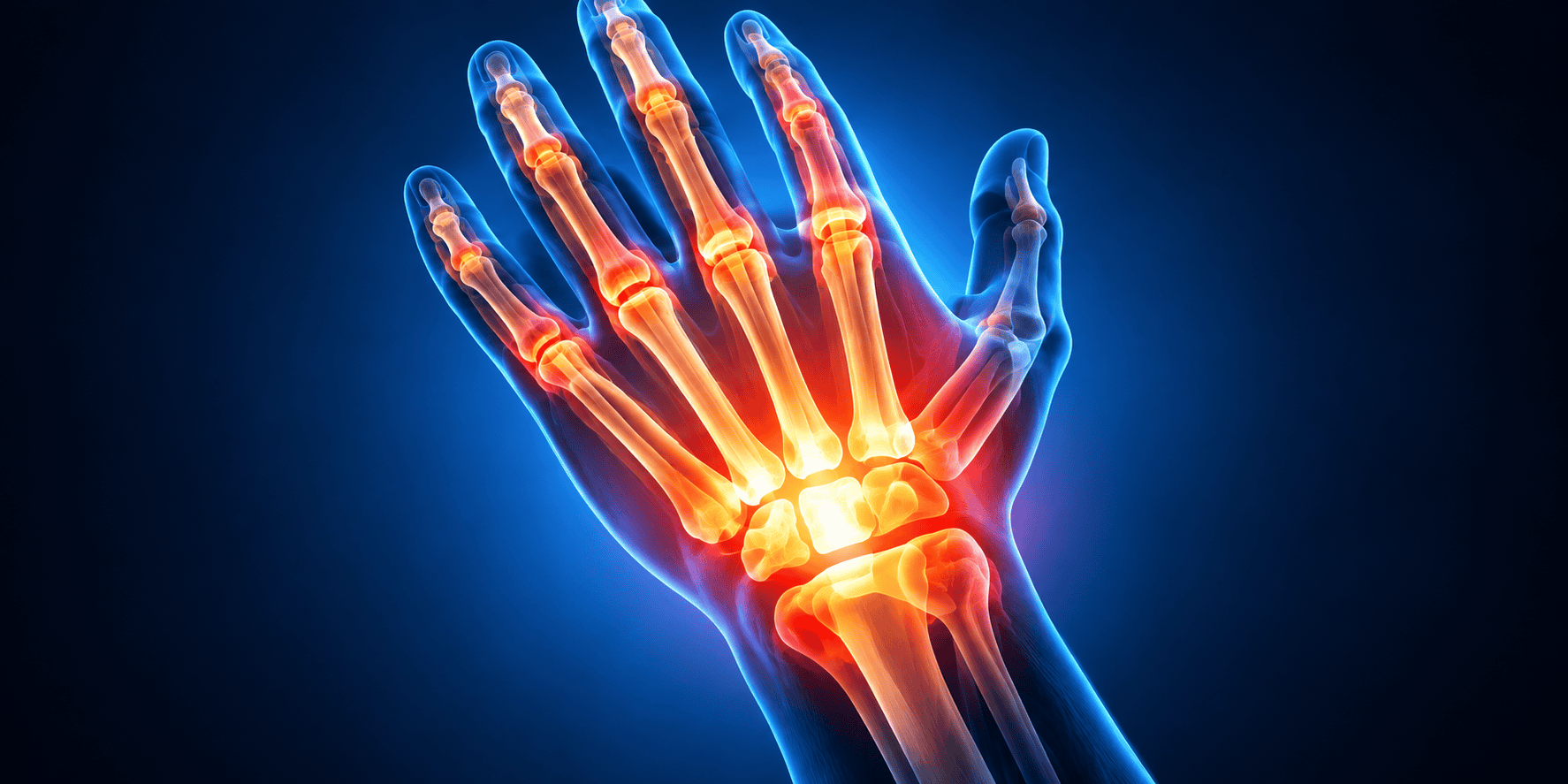 Medical illustration of hand and wrist bones and joints for a stem cell therapy website
